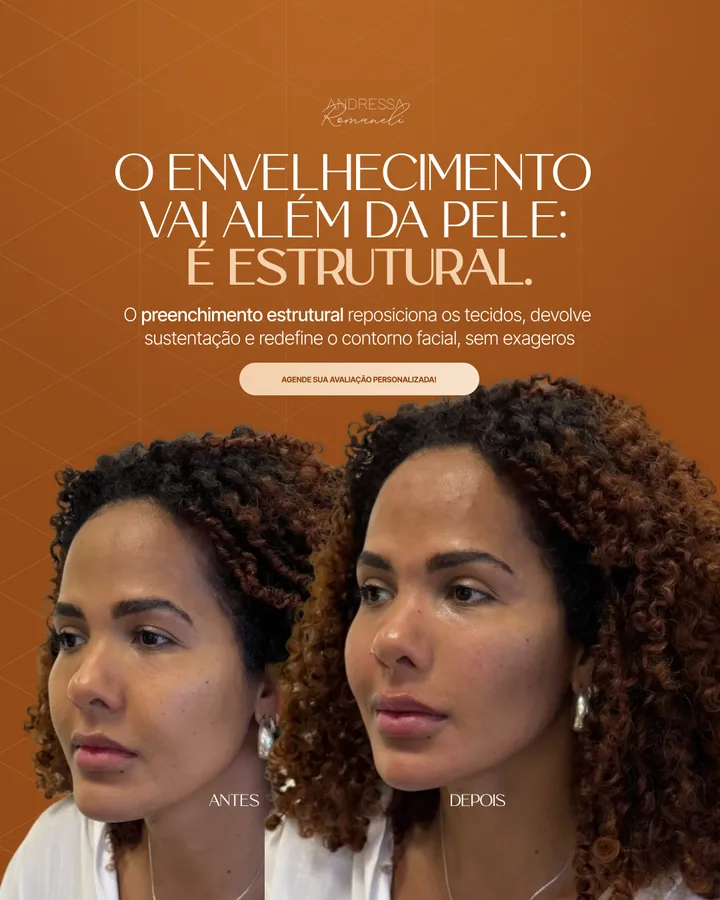 Criativo para anúncio 20 desenvolvido pela Black Creative